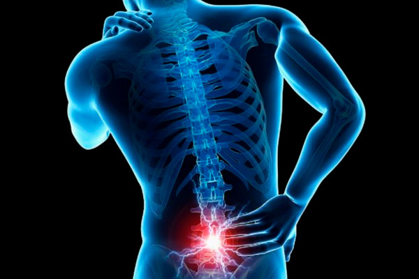 Lumbalgia